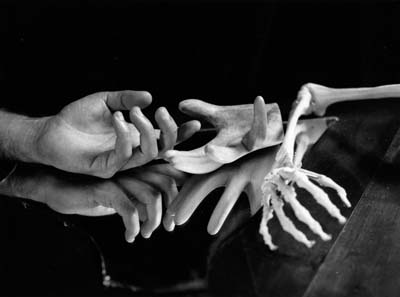 Hands of a Hand Surgeon 2, 1973