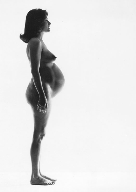 USA. New York City. 1977. Susan and baby (before). (NYC18441)